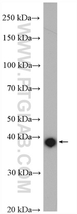 FAH Antibody in Western Blot (WB)