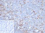 CTLA4/CD152 (Negative Regulator of T-Cells) Antibody in Immunohistochemistry (Paraffin) (IHC (P))