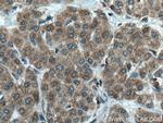 GALNS Antibody in Immunohistochemistry (Paraffin) (IHC (P))