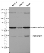 GALNS Antibody in Western Blot (WB)