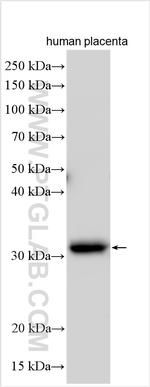 CLIC2 Antibody in Western Blot (WB)