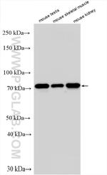 RECQL Antibody in Western Blot (WB)