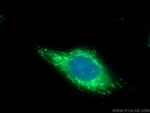 BLMH Antibody in Immunocytochemistry (ICC/IF)