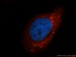 BLMH Antibody in Immunocytochemistry (ICC/IF)