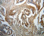 BLMH Antibody in Immunohistochemistry (Paraffin) (IHC (P))