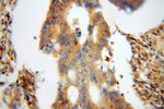 BLMH Antibody in Immunohistochemistry (Paraffin) (IHC (P))