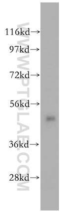 BLMH Antibody in Western Blot (WB)