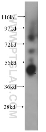 BLMH Antibody in Western Blot (WB)