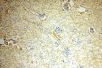OVCA2 Antibody in Immunohistochemistry (Paraffin) (IHC (P))