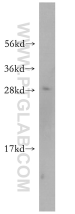 OVCA2 Antibody in Western Blot (WB)