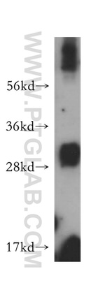 OVCA2 Antibody in Western Blot (WB)