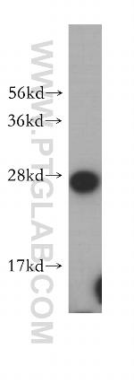 OVCA2 Antibody in Western Blot (WB)