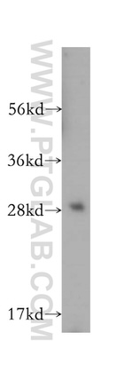 OVCA2 Antibody in Western Blot (WB)