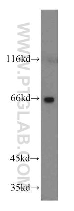 Cyclon/CCDC86 Antibody in Western Blot (WB)