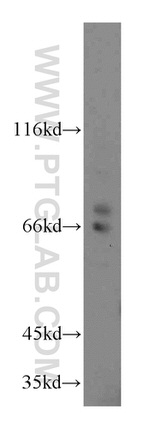 Cyclon/CCDC86 Antibody in Western Blot (WB)