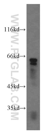 Cyclon/CCDC86 Antibody in Western Blot (WB)