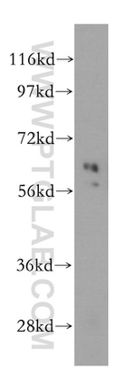 Cyclon/CCDC86 Antibody in Western Blot (WB)