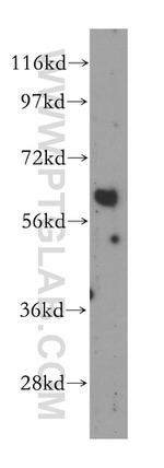 Cyclon/CCDC86 Antibody in Western Blot (WB)