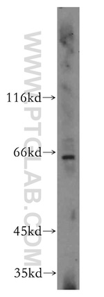 Cyclon/CCDC86 Antibody in Western Blot (WB)