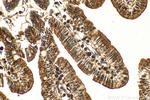 ARIH1 Antibody in Immunohistochemistry (Paraffin) (IHC (P))