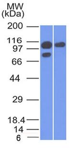Catenin, alpha-1 (CTNNA1) Monoclonal Antibody (1G5)