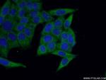 KARS Antibody in Immunocytochemistry (ICC/IF)