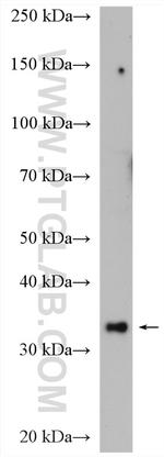 SNX11 Antibody in Western Blot (WB)