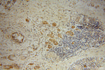 BEGAIN Antibody in Immunohistochemistry (Paraffin) (IHC (P))