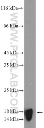 RPS15 Antibody in Western Blot (WB)