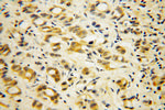 PABPC4 Antibody in Immunohistochemistry (Paraffin) (IHC (P))