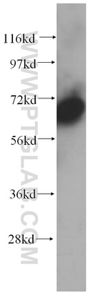 PABPC4 Antibody in Western Blot (WB)