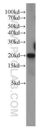 POP7 Antibody in Western Blot (WB)