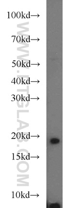 POP7 Antibody in Western Blot (WB)