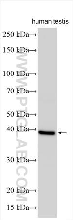 MAGEA9 Antibody in Western Blot (WB)