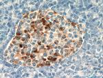 Chromogranin B Antibody in Immunohistochemistry (Paraffin) (IHC (P))