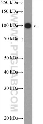 Chromogranin B Antibody in Western Blot (WB)
