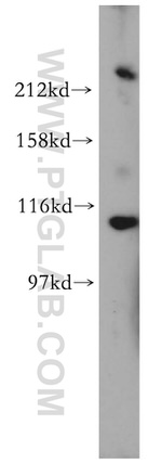 Chromogranin B Antibody in Western Blot (WB)