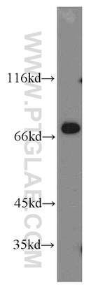 KATNB1 Antibody in Western Blot (WB)