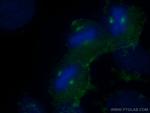 KATNB1 Antibody in Immunocytochemistry (ICC/IF)
