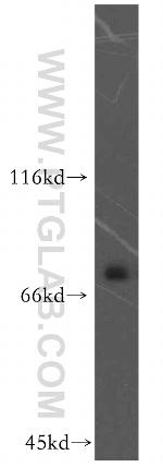 KATNB1 Antibody in Western Blot (WB)