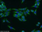 TRMT1 Antibody in Immunocytochemistry (ICC/IF)