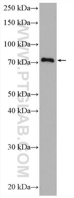 TRMT1 Antibody in Western Blot (WB)