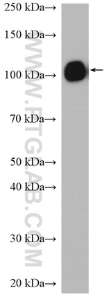 MTMR14 Antibody in Western Blot (WB)