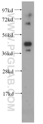 HNRNPF Antibody in Western Blot (WB)