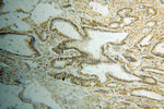 HNRNPF Antibody in Immunohistochemistry (Paraffin) (IHC (P))