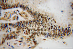 HNRNPF Antibody in Immunohistochemistry (Paraffin) (IHC (P))