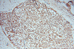 SNRPF Antibody in Immunohistochemistry (Paraffin) (IHC (P))