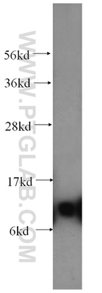 SNRPF Antibody in Western Blot (WB)