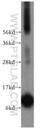 SNRPF Antibody in Western Blot (WB)