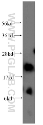 AK1 Antibody in Western Blot (WB)
